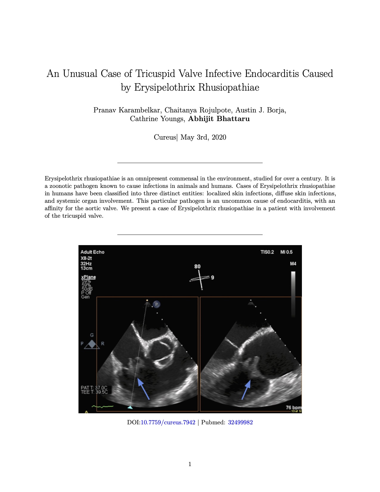 Endocarditis